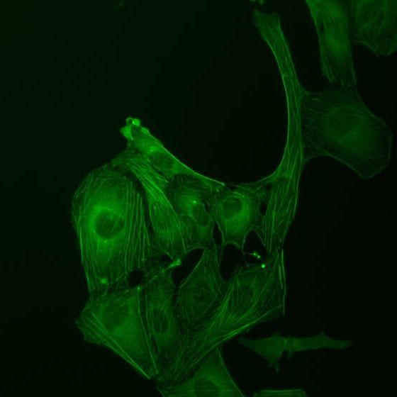 U2OS 骨肉瘤細胞，GFP 染色，熒光觀察方式